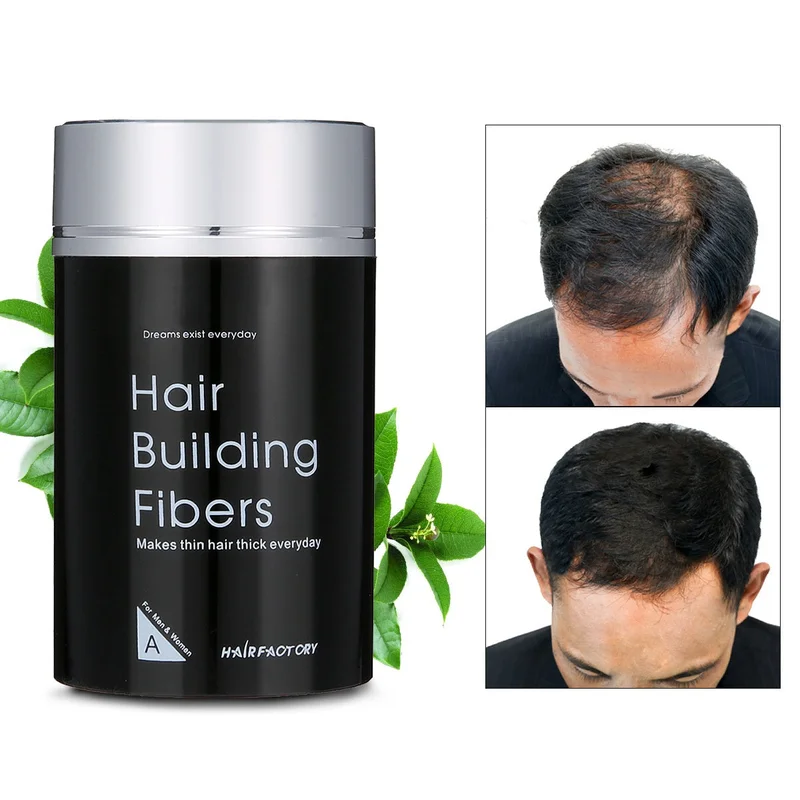 allesxl-12984391